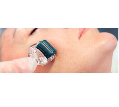 DERMA ROLLER PEEL - Image 3